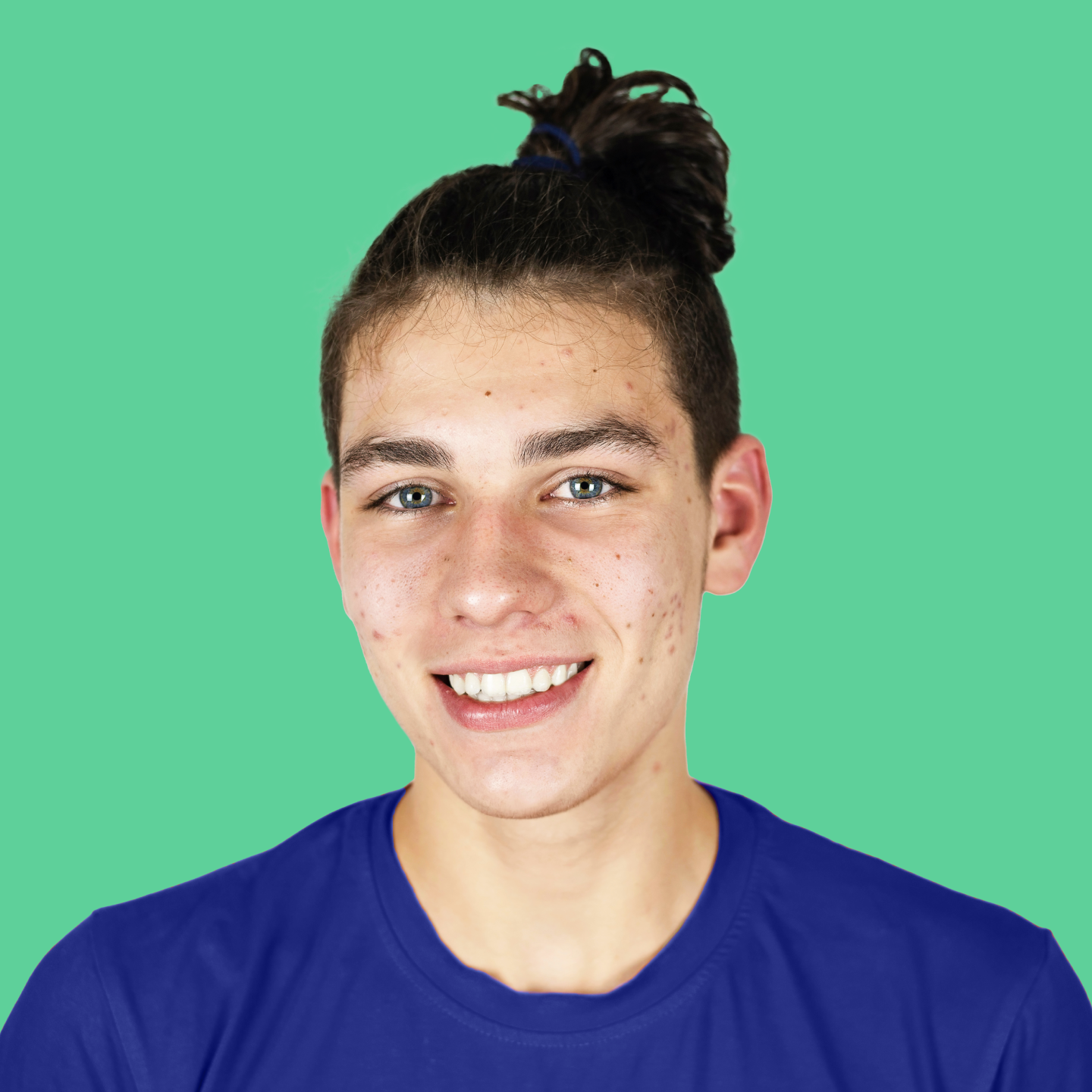 Younger male teenager with visible acne smiling confidently at camera.